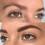 Eyebrow Enhancement