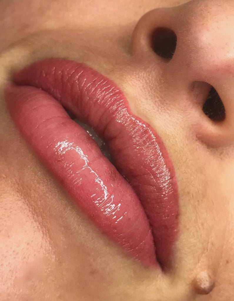 Vogue Williams Lips