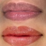 Melanin-Rich Lips Correction