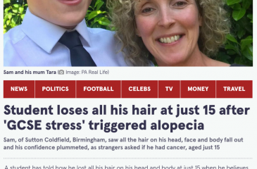 Daily Mirror Alopecia Eyebrows