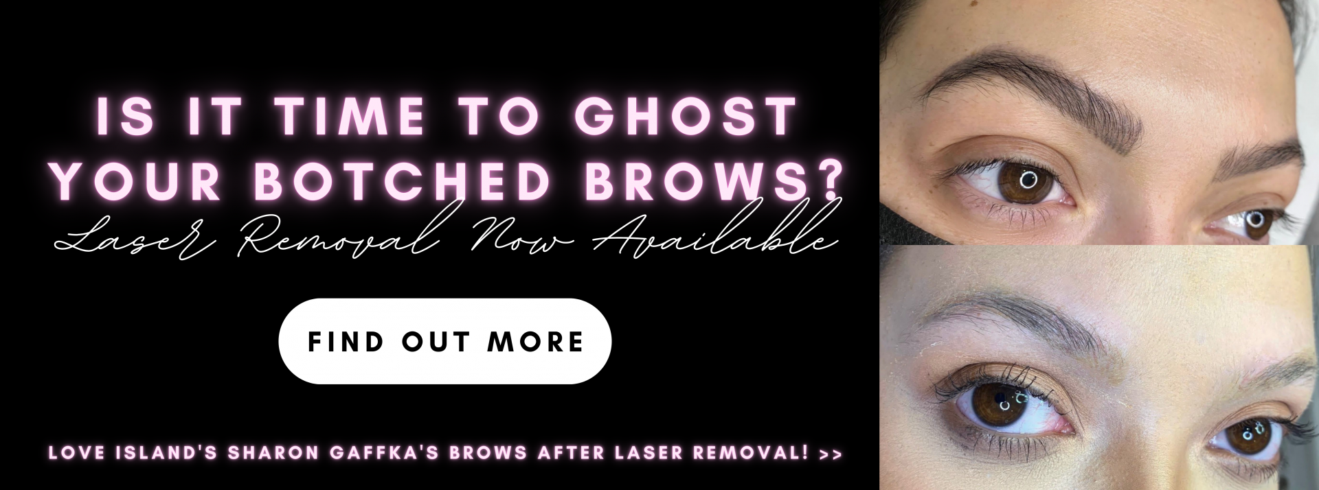 Permanent Makeup Laser Removal