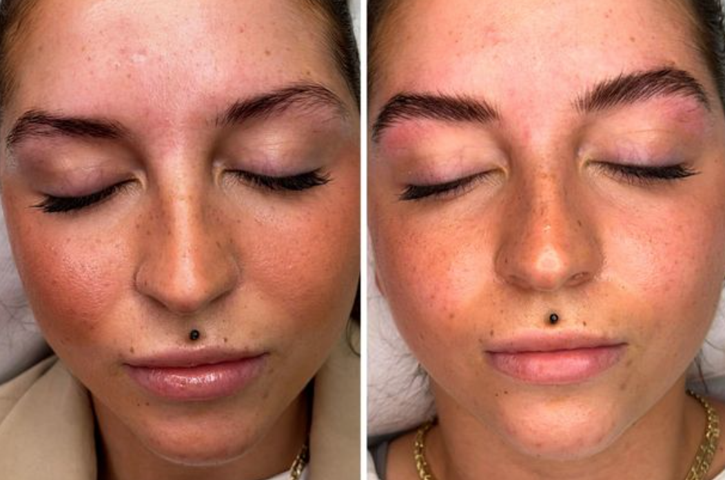 Before and after hyperrealism brows