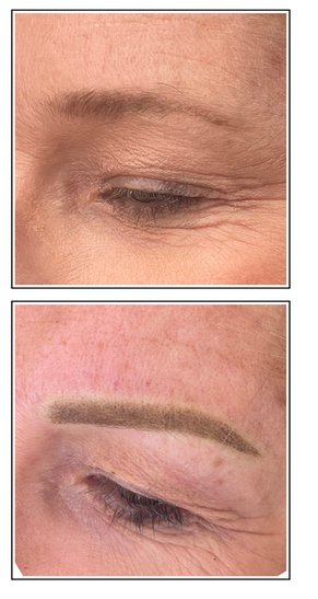 Before and After Eyebrow Tattooing