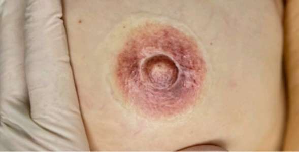 Areola Tattoo Training